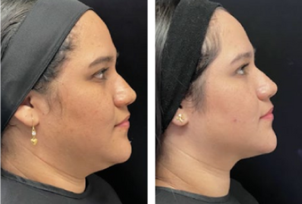 Dra Andrea Vidal medicina estetica en Cali
