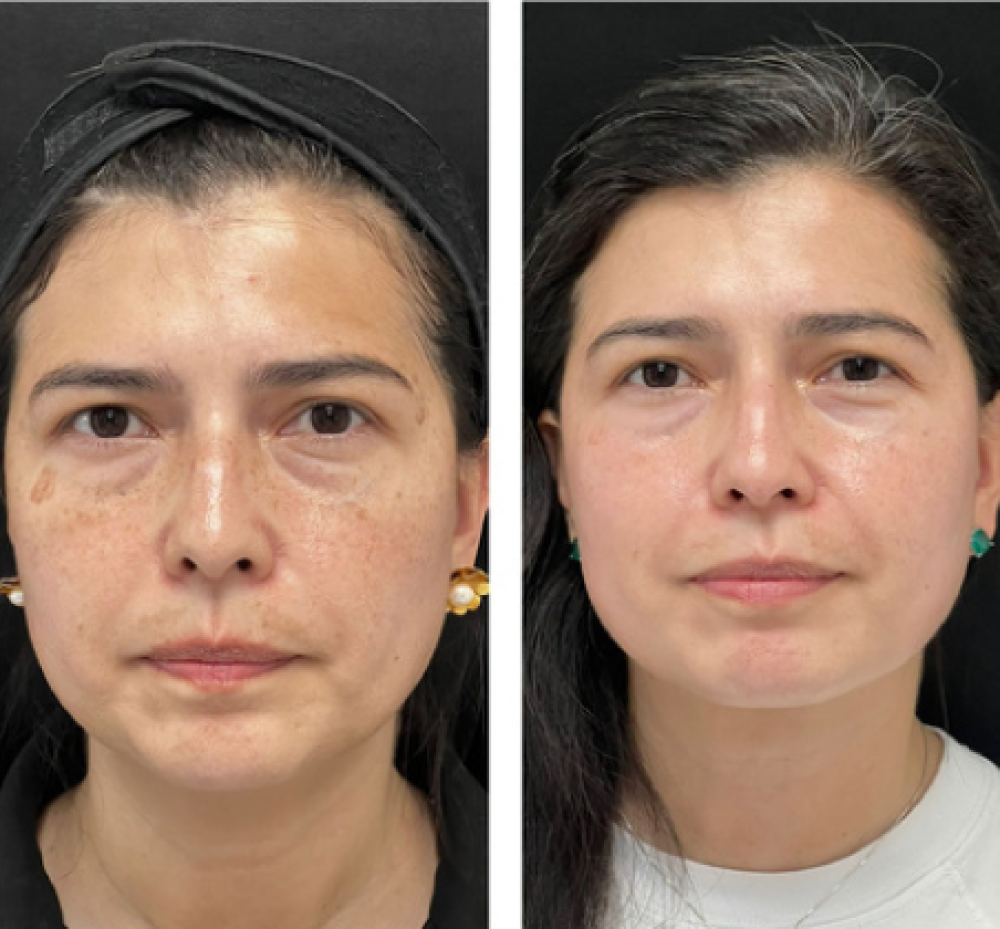 Medicina estetica en cali